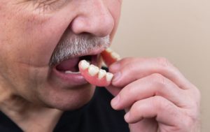 fumeurs perdent plus de dents